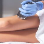 velashape kezelés